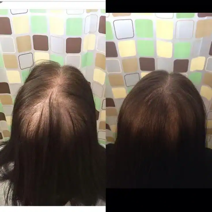 نتيجة بعد 45 يوم